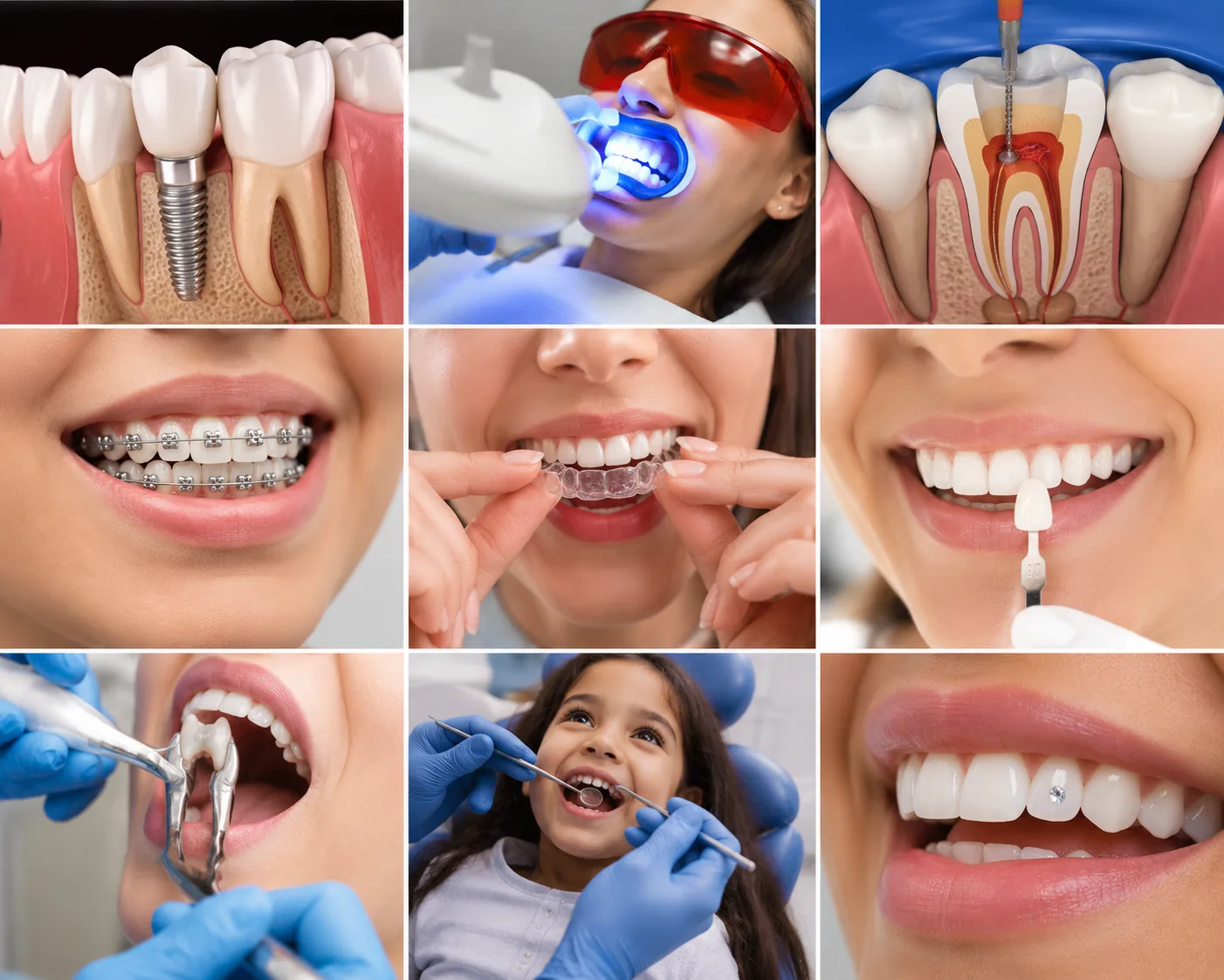 Dental Jewellery at Transcend Dental Clinic Hinjawadi Pune