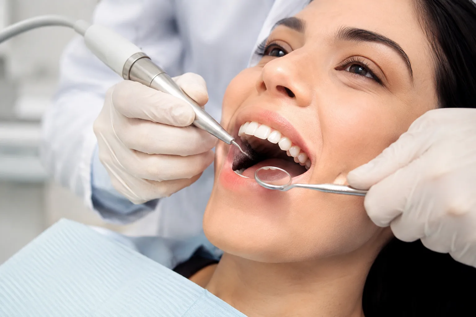 Scaling & Polishing at Transcend Dental Clinic Hinjawadi Pune